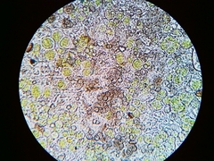 Phaeocalicium populneum