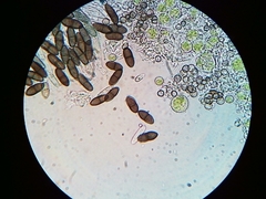 Phaeocalicium populneum