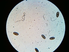 Phaeocalicium populneum