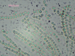 Trichoderma citrinoviride