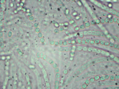 Trichoderma citrinoviride