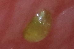 Wolffia brasiliensis