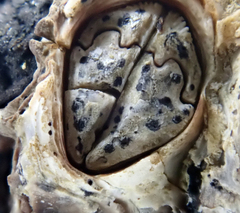 Collemopsidium ostrearum