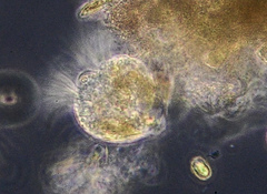 Strobilidium