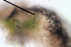 Rinodina pachysperma