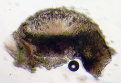 Rinodina pachysperma
