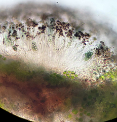 Rinodina pachysperma