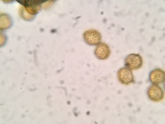 Perichaena corticalis