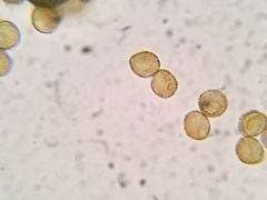 Perichaena corticalis