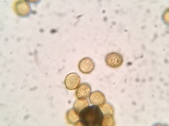 Perichaena corticalis