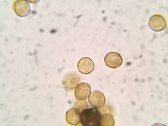 Perichaena corticalis