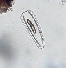 Surirella