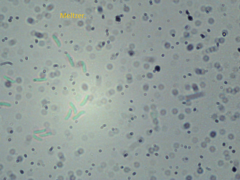 Fuscopostia leucomallella