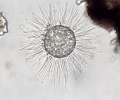 Acanthocystis