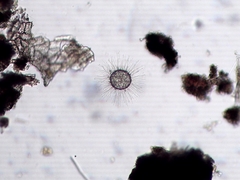 Acanthocystis