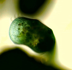 Stentor coeruleus