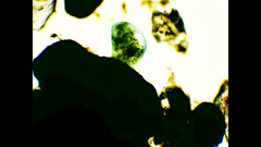 Stentor coeruleus