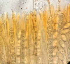 Anthracobia macrocystis