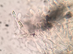 Hyphodontia arguta