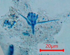 Tetracladium setigerum