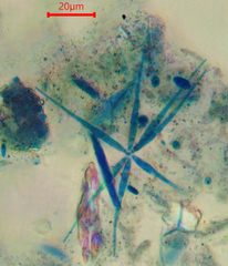 Flabellospora acuminata