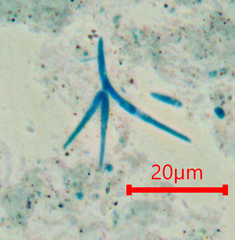 Alatospora acuminata