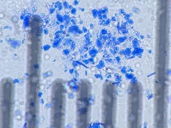 Bacillus