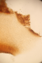 Dacryopinax elegans image