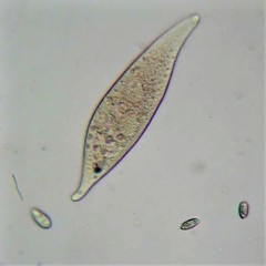 Amphileptus pleurosigma