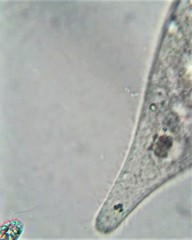 Amphileptus pleurosigma