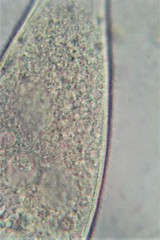 Amphileptus pleurosigma