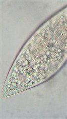 Amphileptus pleurosigma