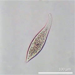 Amphileptus pleurosigma