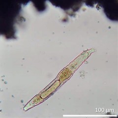 Habrotrocha collaris