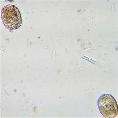 Habrotrocha collaris