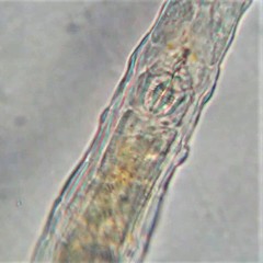 Habrotrocha collaris