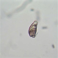 Lecane closterocerca