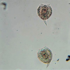 Lecane closterocerca