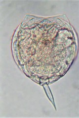 Lecane closterocerca