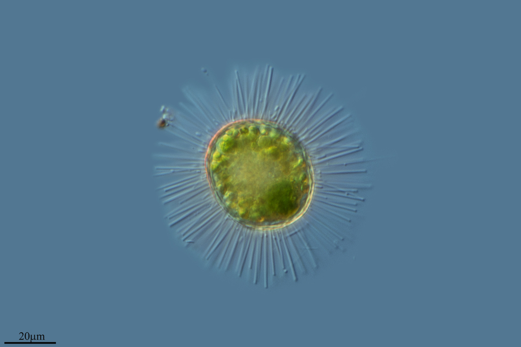 Heliozoa Unitec Te Pukenga Guide Organisms In Fresh Water INaturalist heliozoa-unitec-te-pukenga-guide-organisms-in-fresh-water-inaturalist