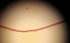 Planktothrix rubescens