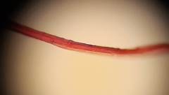Planktothrix rubescens