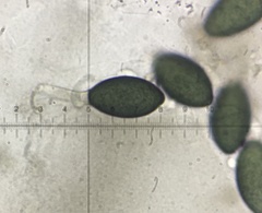 Podospora anserina
