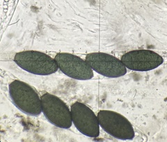 Podospora anserina