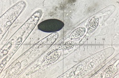 Podospora anserina