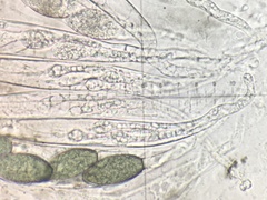 Podospora anserina