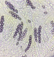 Ascobolus crenulatus