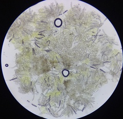 Ascobolus crenulatus