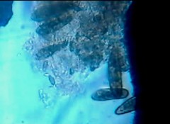 Paramecium caudata