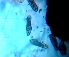 Paramecium caudata